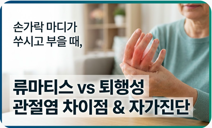 손가락 마디 쑤시고 부을 때, 류마티스 관절염과 퇴행성 관절염 차이점 및 자가진단법