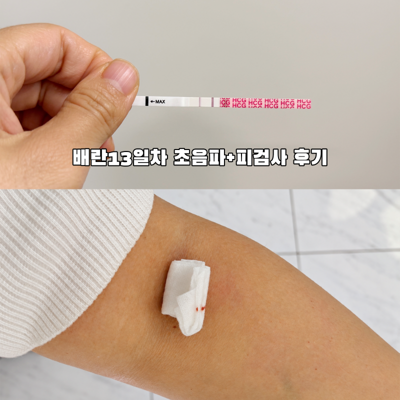 배란 13일차, hCG 수치확인 피검사와 초음파검사 해보니 (w여성병원)