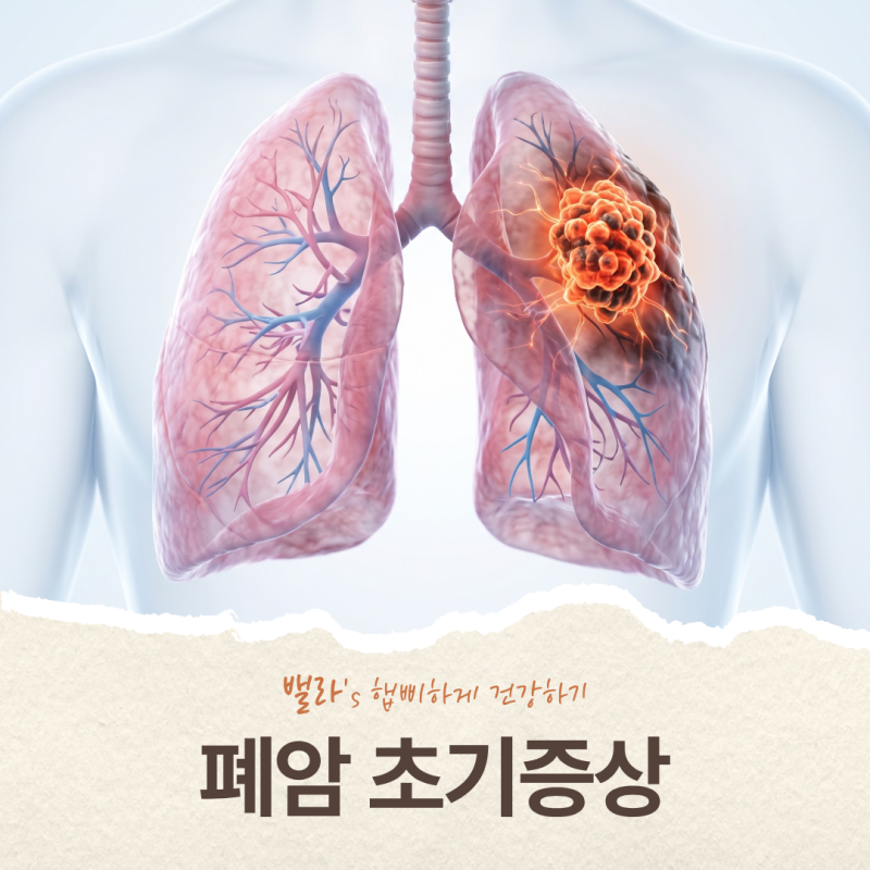 폐암 초기증상, 기침과 통증만으로 알 수 없는 이유와 진료 시점