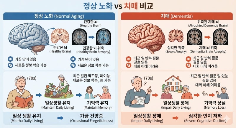기억력이 떨어진다면? 치매 초기증상과 검사·치료 방법