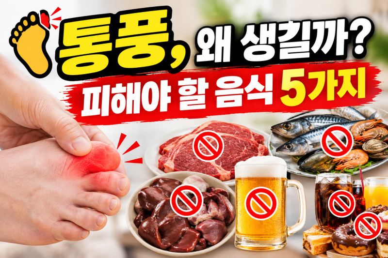 통풍 생기는 이유와 음식, 이것부터 알아야 합니다