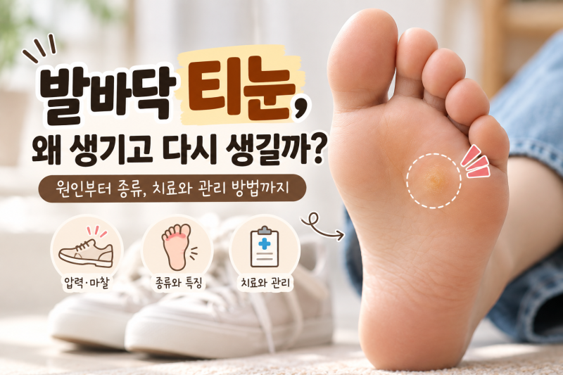 발바닥 티눈 원인과 제거 방법, 재발하는 이유와 사마귀 차이