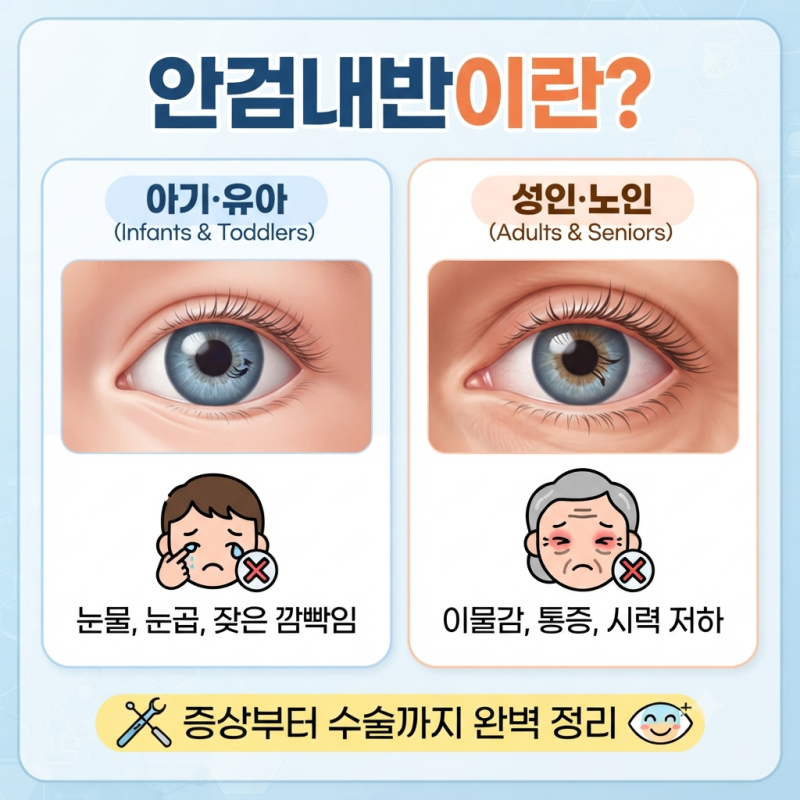 안검내반뜻정의 아기,유아부터 성인 증상, 수술까지 알아보기