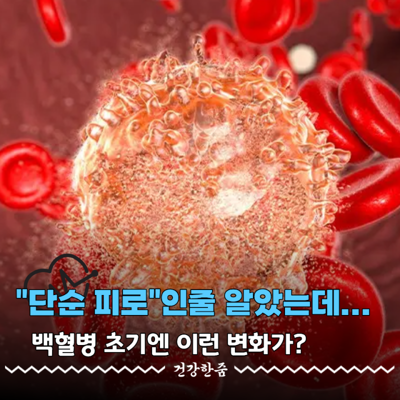 단순 피로인 줄 알았는데... 급성 백혈병 초기에도 나타날 수 있는 "이 변화"