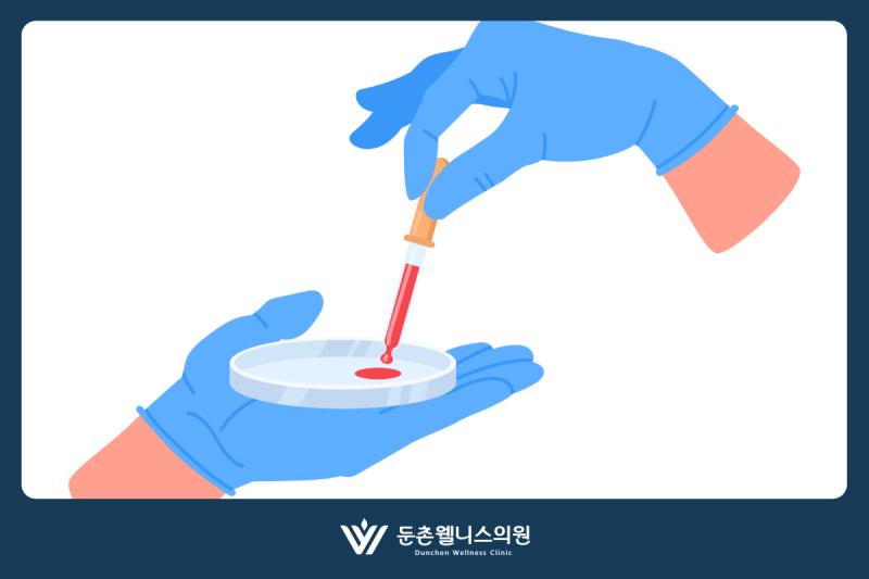 건강검진 혈액검사결과 간수치 AST·ALT·감마GTP가 높게 나왔을 때 해석 방법은?