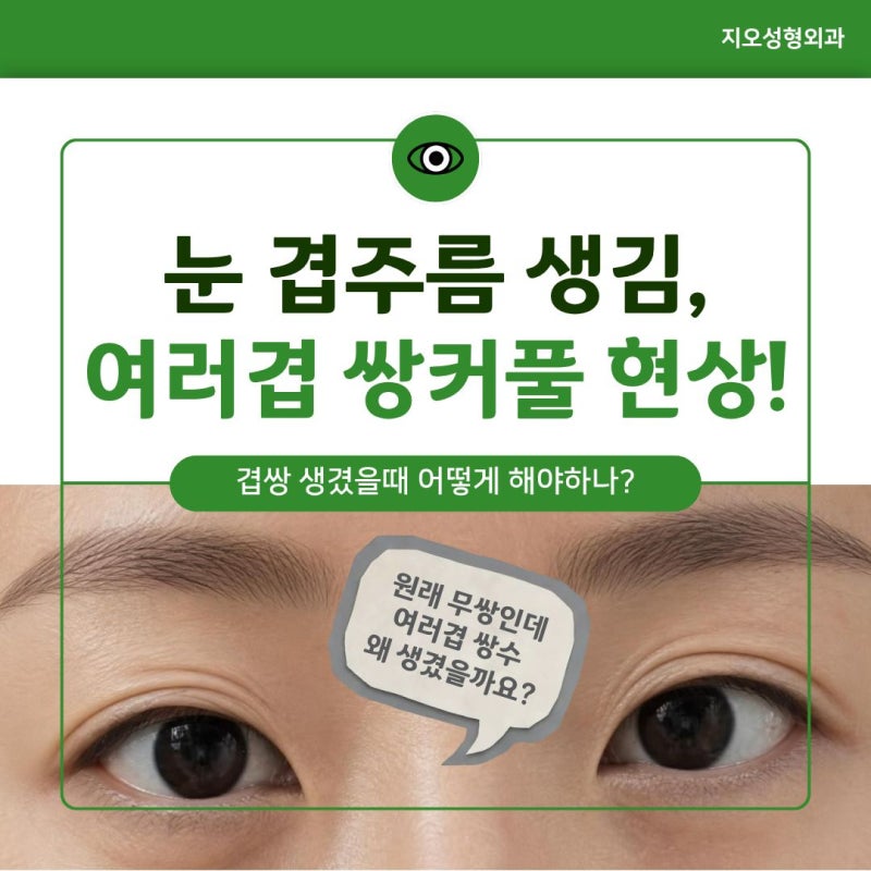 눈겹주름 생기면서 여러겹 쌍커풀 변했는데 고쳐야 할까
