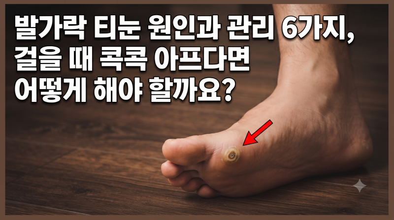 발가락 티눈 원인과 관리 6가지, 걸을 때 콕콕 아프다면 어떻게 해야 할까요?