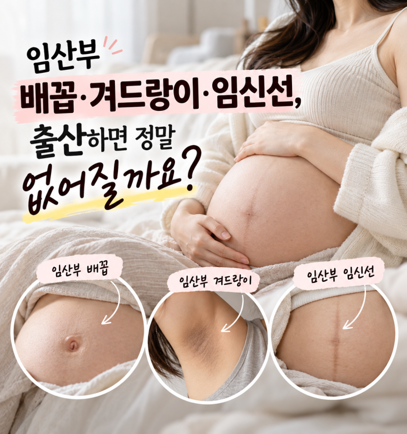 임산부 배꼽, 겨드랑이, 임신선.. 출산하면 정말 없어질까요?