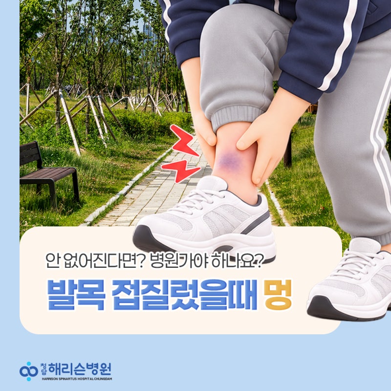 발목 접질렀을때 멍 일정 기간 지나도 안 없어진다면? 병원가야 하나요?