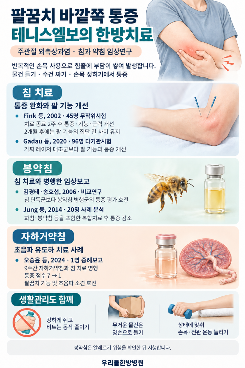 팔꿈치 바깥쪽 통증, 테니스엘보의 한방치료 — 침·약침 임상연구와 함께 알....