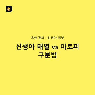 신생아 태열 vs 아토피 구분법, 헷갈릴 때 체크리스트