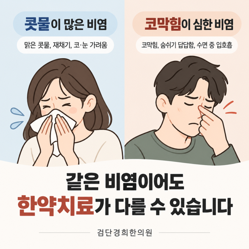 콧물이 많은 비염과 코막힘이 심한 비염, 한약치료가 다른 이유