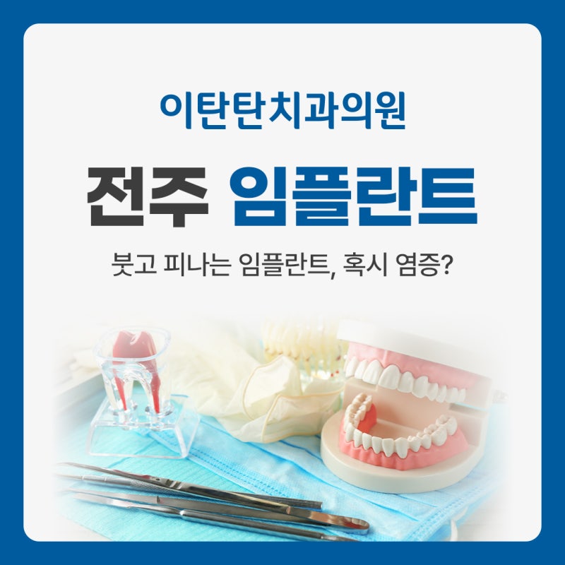 전주 임플란트, 주변에 염증이 생겼다면 꼭 확인하세요