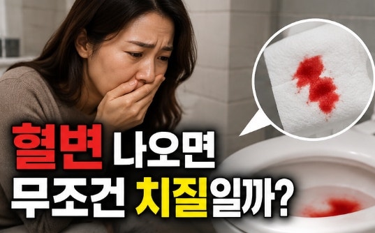 혈변 나오면 무조건 치질일까? 치질과 대장암 증상 어떻게 다를까