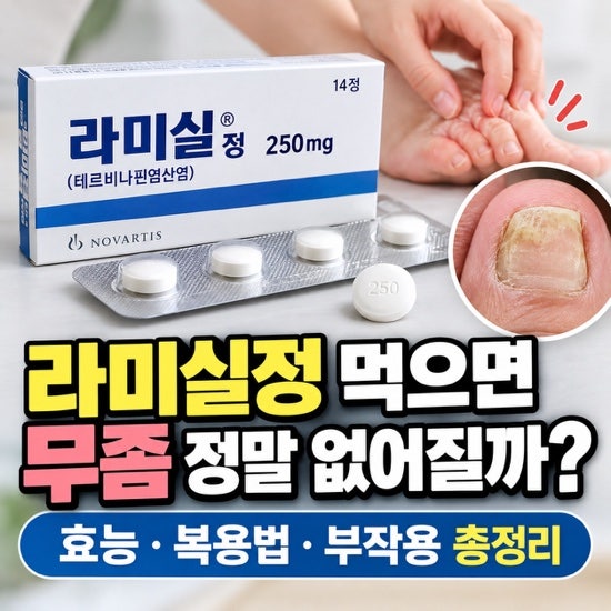 라미실정 먹으면 무좀 정말 없어질까? 효능부터 부작용까지