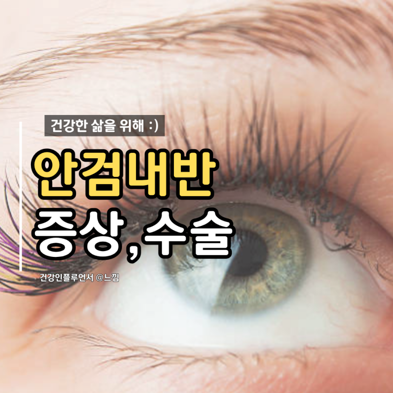 안검내반 수술 및 증상 원인은?
