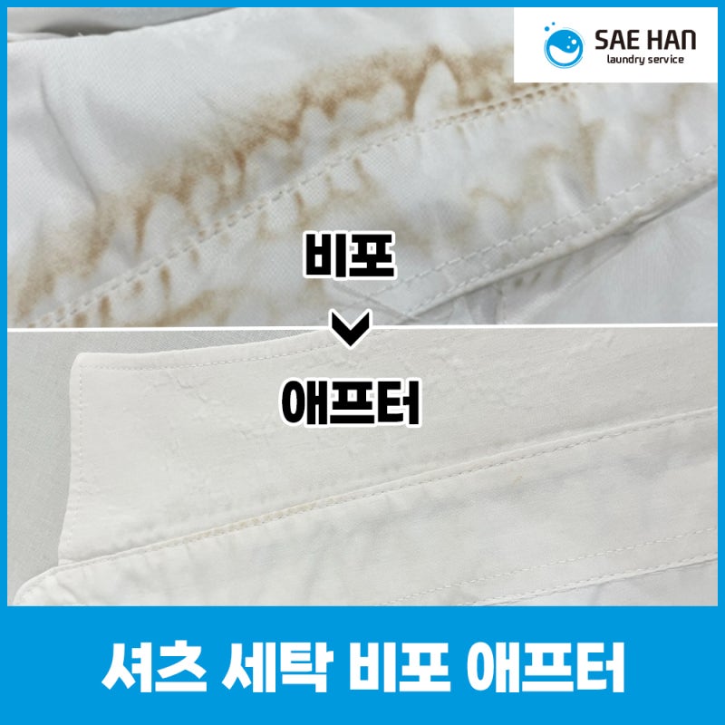 조리복 세탁 맡겨도 누렇게 되는 이유 3가지