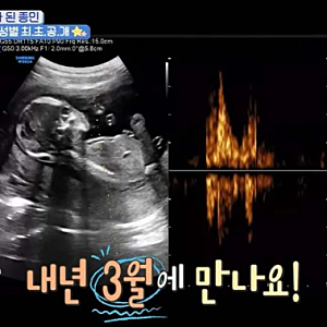 '11살 연하♥' 김종민, 드디어 아들 아빠 된다..."태몽만 세 번 꿨다"