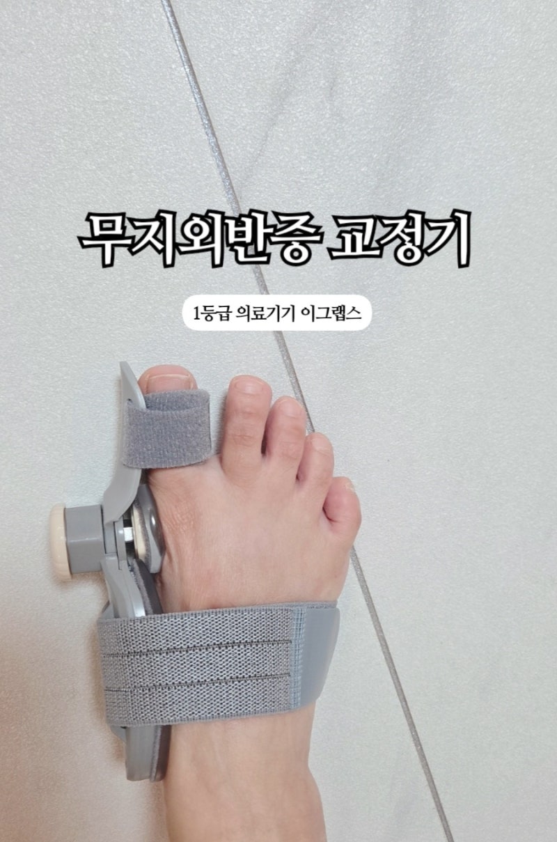무지외반증 교정기 추천 ! 편안한 착용감의 이그랩스 발가락 교정기 후기