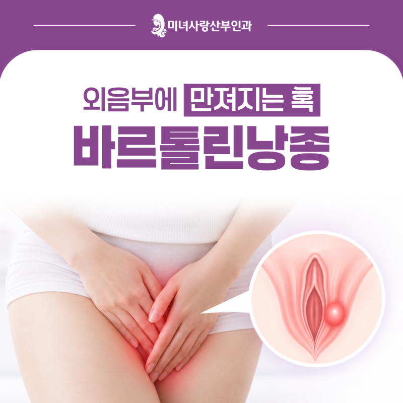 역삼산부인과 외음부 혹이 생겼다면 ‘바르톨린낭종’ 확인해보세요