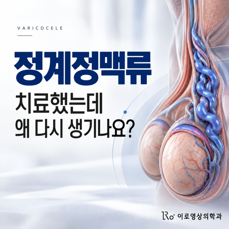 정계정맥류, 치료했는데 왜 다시 생기나요? | 재발의 해부학적 원인과 치료법별 재발률·재치....
