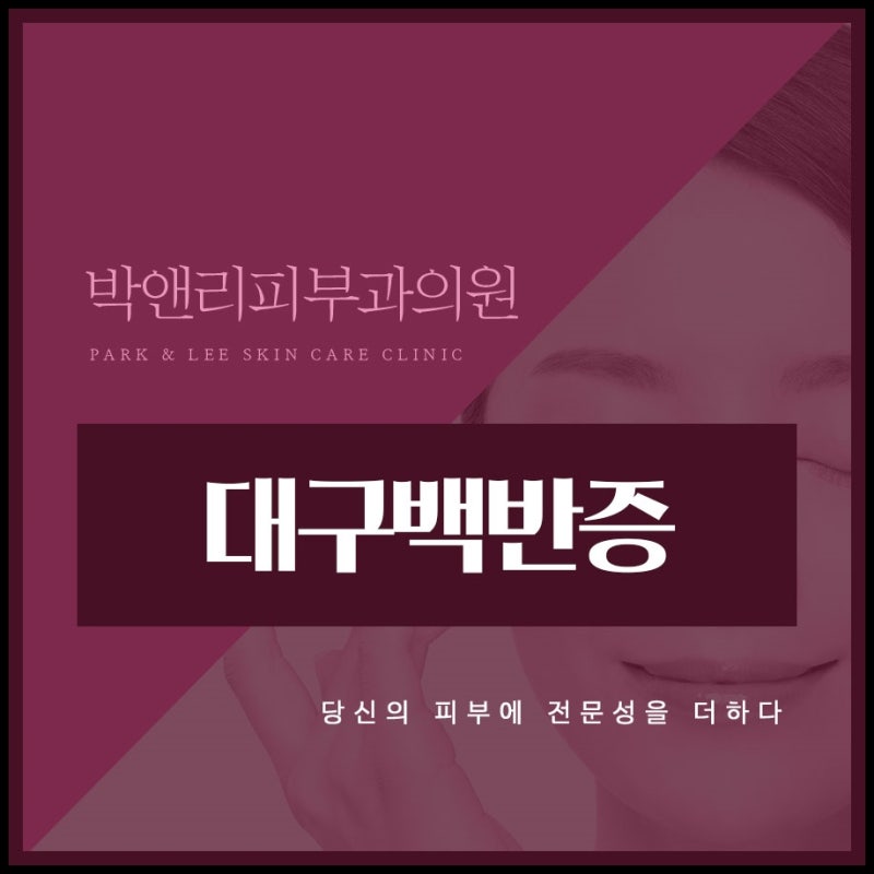 대구피부과 백반증 피부에 흰 반점이 생기는 걸까요?