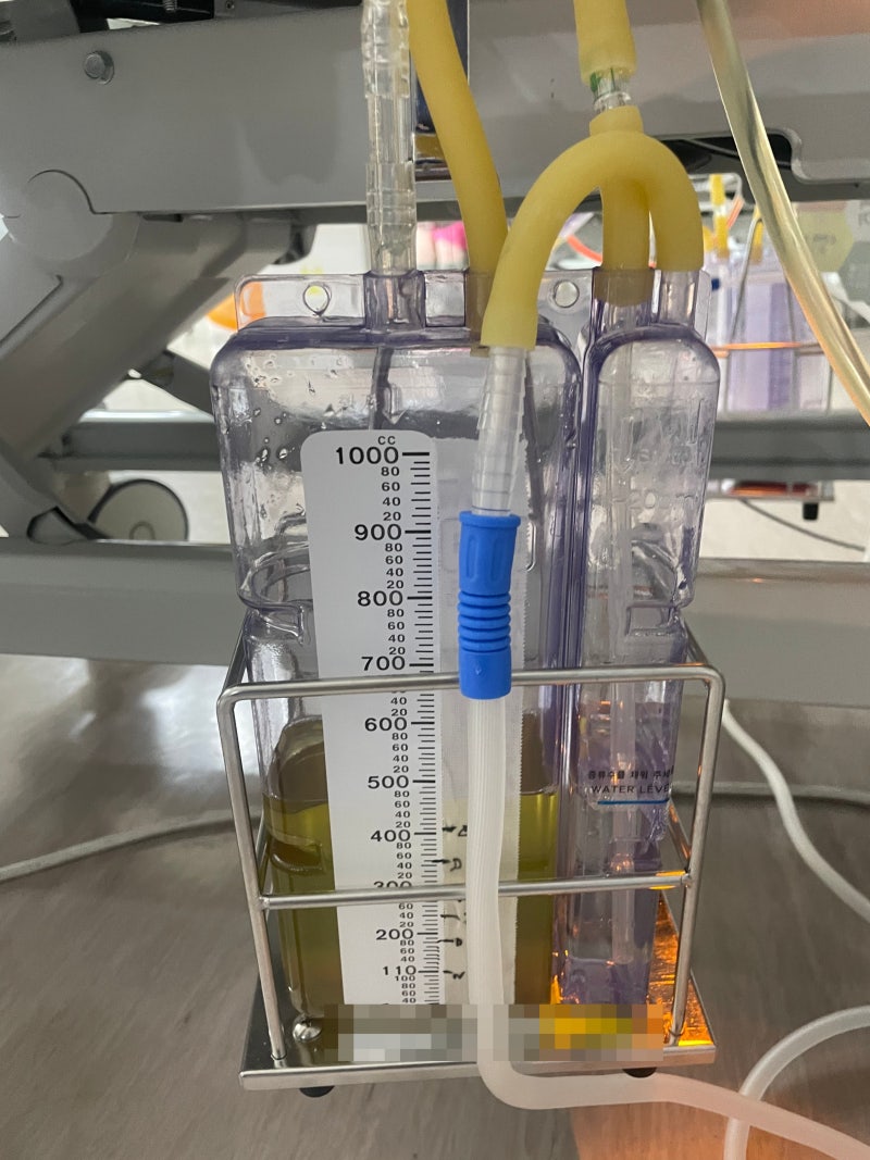 중환자실 30일차.. / 흉관(Chest tube) A타입과 C타입에 대해 알아보자 / +흉관 bubbling 영상 추가, ....