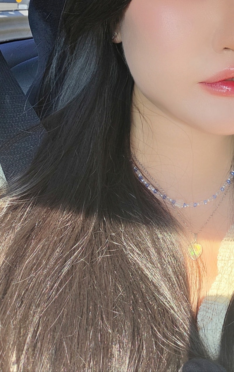 지루성 피부염 여드름 영양제 마이디데이 퀘르민 후기 찐 변화