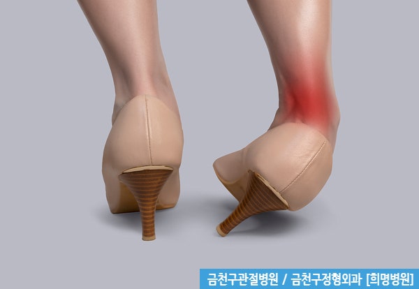 금천구관절병원 / 발목염좌 통증 및 부종 방치, 발목불안정증 초래 위험