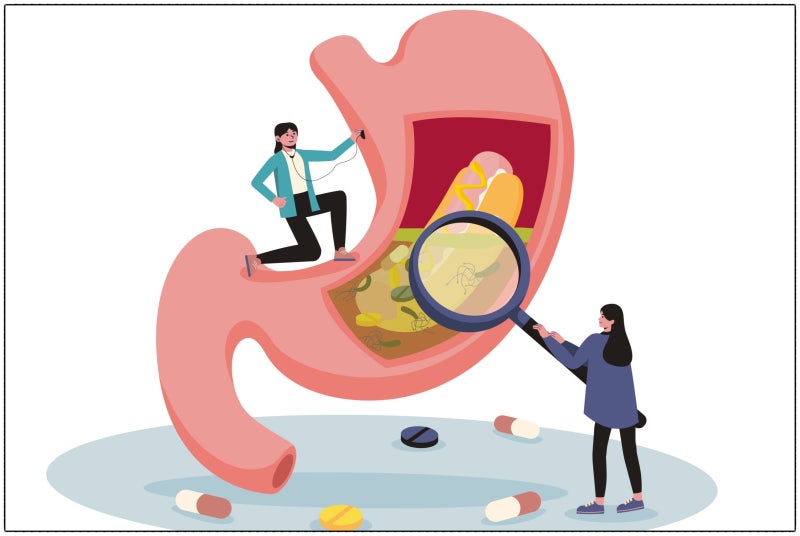 아침마다 가스 차고 설사한다면? 과민성대장증후군 원인과 식단 관리 대처법