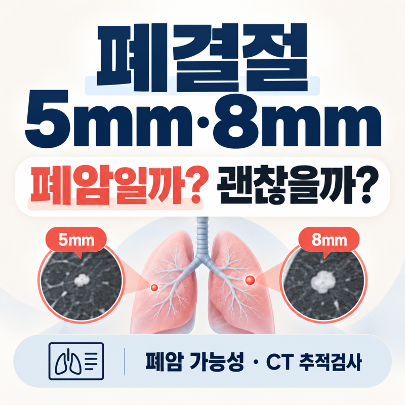 폐결절 5mm·8mm 괜찮을까? 폐암 가능성과 추적검사 확인