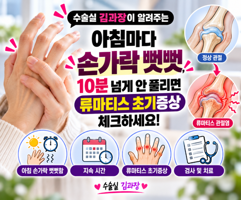 아침마다 손가락 뻣뻣, 10분 넘게 안 풀리면 류마티스 초기증상 체크하세요!