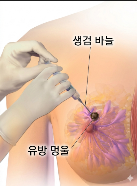 유방 조직검사부터 종양 제거까지 한 번에