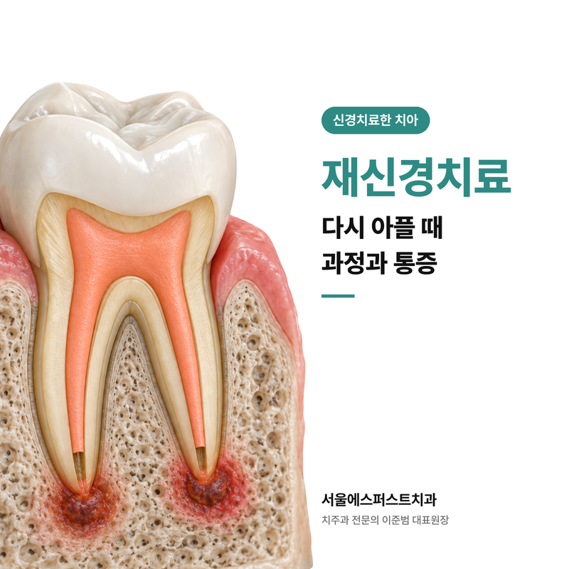 여수동치과 재신경치료, 다시 아픈 치아의 치료 과정과 통증