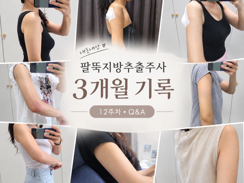 팔뚝 지방추출주사 후기 3개월차｜1주차~12주차 변화 총정리 & Q&A