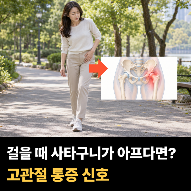걸을 때마다 사타구니가 불편하다면…고관절에서 보내는 "이 신호"?