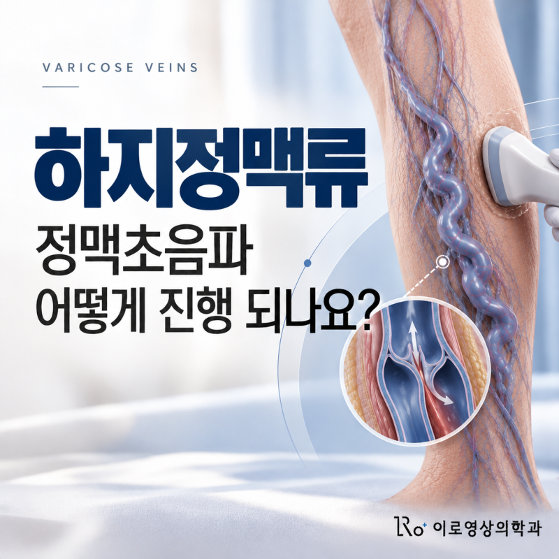 다리 혈관 때문에 초음파를 보자고 합니다 | 하지정맥류 정맥초음파는 어떻게 진행되고, 무....
