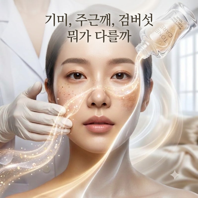 색소침착 기미 주근깨 검버섯 차이와 관리법
