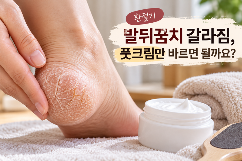 발뒤꿈치 갈라짐, 풋크림만 발라도 될까? 약국 크림 4가지 비교