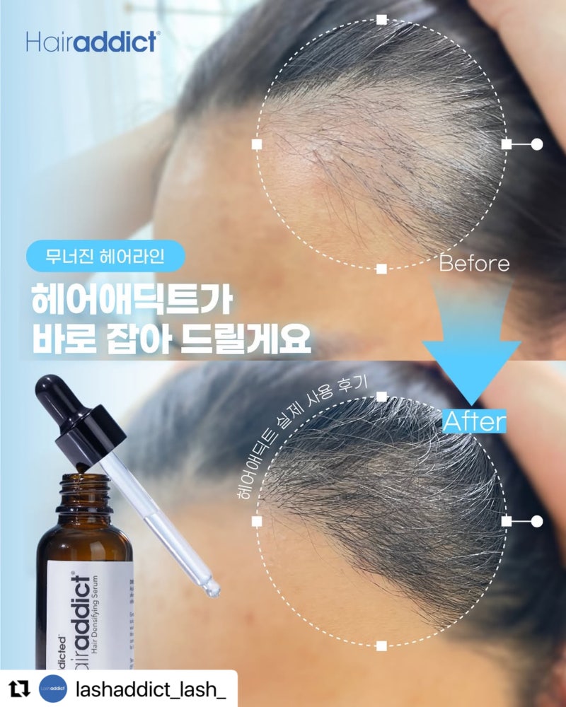 부산 래쉬애딕트 헤어애딕트 정품 최저가 구매 방법(산후탈모·짧은 속눈썹)