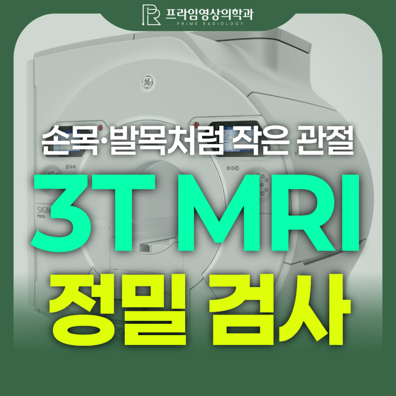 손목·발목처럼 작은 관절도 MRI로 확인 가능할까? 3.0T MRI를 활용한 정밀 검사