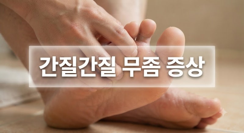 발가락 사이 가려움과 각질, 혹시 무좀? 유형별 증상부터 자가진단, 완치법까지 총정리!