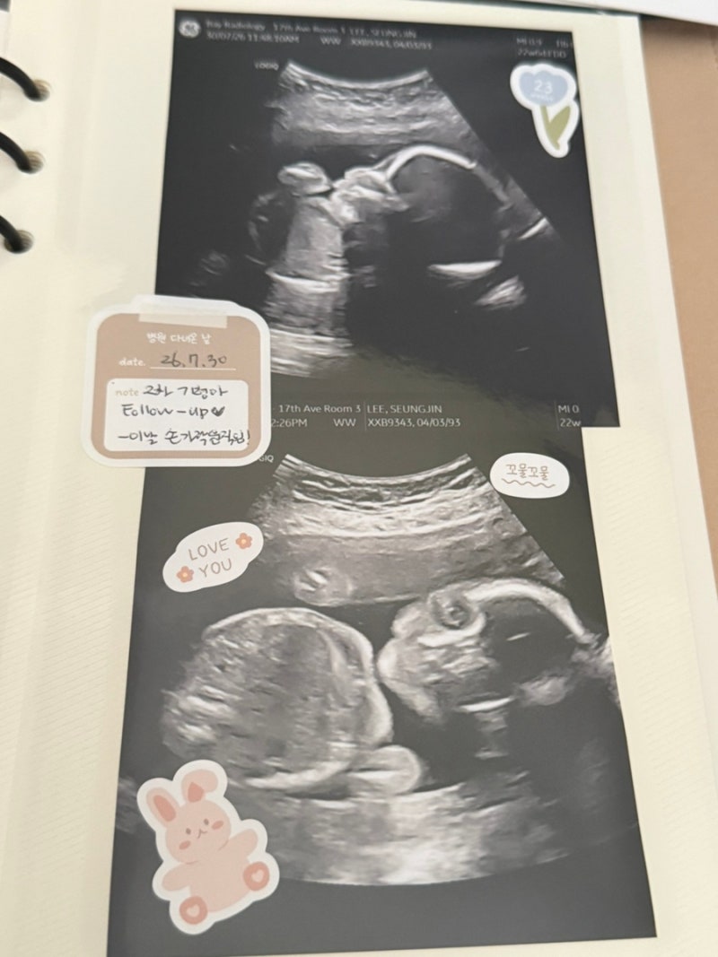 [내돈내산] 신생아 초음파 앨범 추천, 모이라비 초음파 앨범 구매 후기