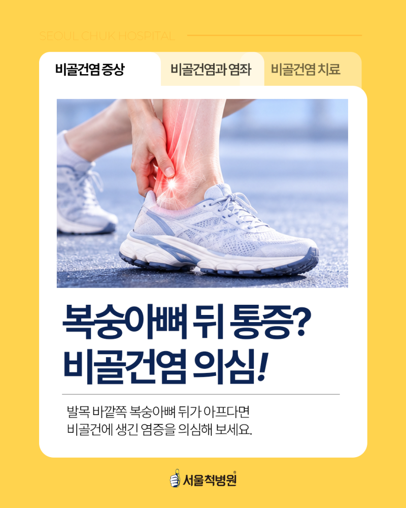 비골건염 증상부터 치료까지, 발목 염좌와 어떻게 다를까?