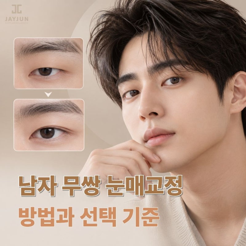 남자 무쌍 눈매교정 방법과 선택 기준