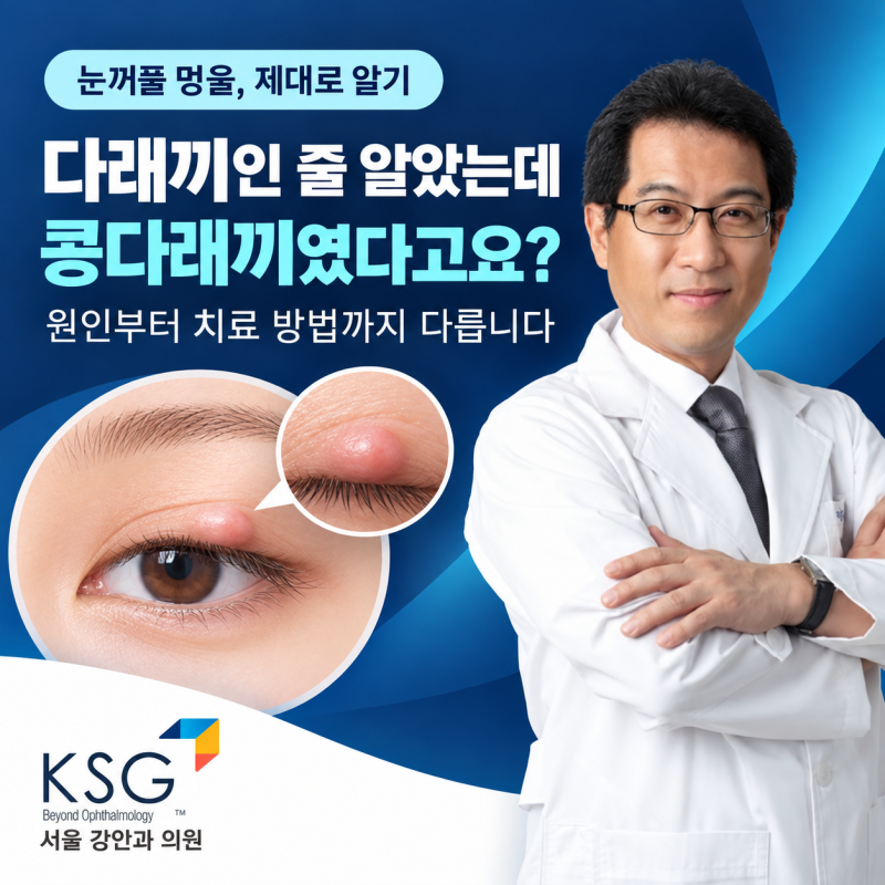 다래끼인 줄 알았는데 콩다래끼였다고요? 치료 방법부터 다릅니다