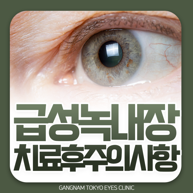 급성녹내장 레이저 치료 후 주의사항 세안부터 일상 복귀까지