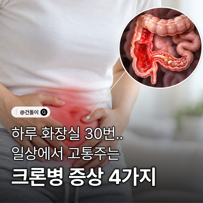 "하루 화장실 30번.." 일상에서 고통주는 크론병 증상 4가지
