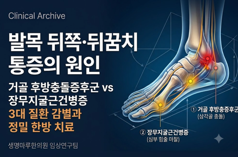 [의학 공부] 발목 뒤쪽 찌릿한 뒤꿈치 통증: 아킬레스건염 vs 거골 후방충돌증후군 vs 장무지....