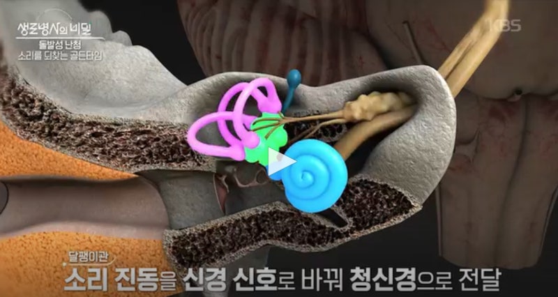 부산동래구보청기,돌발성난청[KBS생로병사의 비밀]
